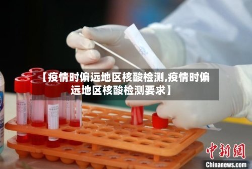 【疫情时偏远地区核酸检测,疫情时偏远地区核酸检测要求】-第3张图片