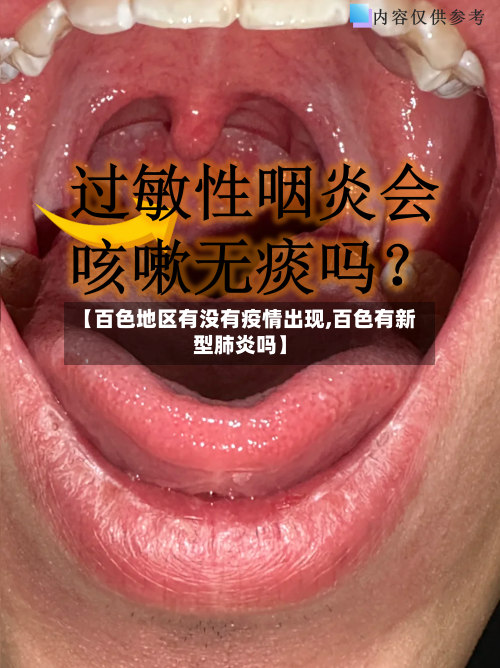 【百色地区有没有疫情出现,百色有新型肺炎吗】